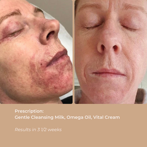 Side-by-side before and after images showing visibly improved, nourished skin after using Bare Roots Omega Oil.