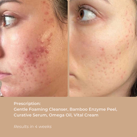Before and after comparison showing visibly smoother, brighter skin post-application