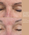 Before and after photos showing skin improvement after using Flora Cream