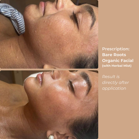 Side-by-side before and after showing skin hydration and glow after using Herbal Mist
