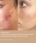 Before and after comparison showing visibly smoother, brighter skin post-application