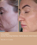 Visible before and after images showing skin clarity improvement from Clarity Serum