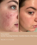 Before and after photos showing skin improvements after using Curative Serum.