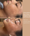 Side-by-side before and after showing skin hydration and glow after using Herbal Mist