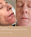 Side-by-side before and after images showing visibly improved, nourished skin after using Bare Roots Omega Oil.