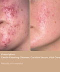 Side-by-side before and after photos showing skin improvement after using Vital Cream.
